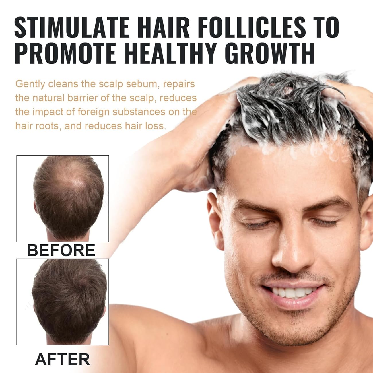 ROOT ACTIVATOR SHAMPOO | STIMULERER HÅRVEKSTEN
