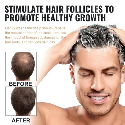 ROOT ACTIVATOR SHAMPOO | STIMULERER HÅRVEKSTEN